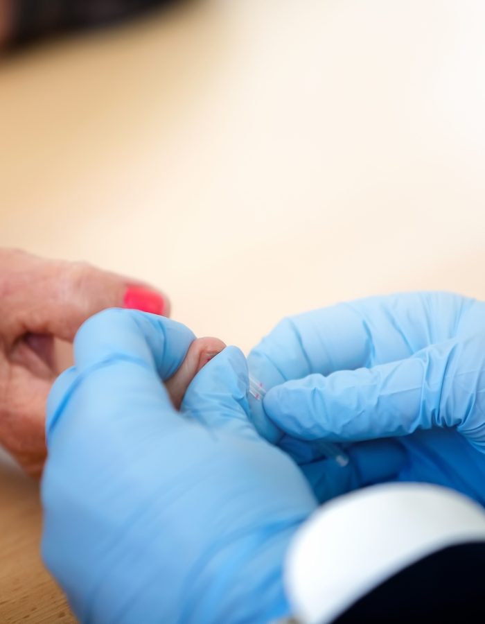  Profesional de salud realizando una prueba de glucosa en un dedo de un paciente.